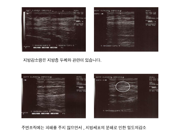 리포덤