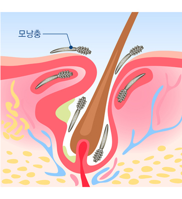 아쿠아필